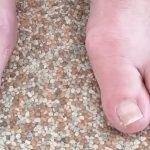 Hallux valgus, scheve grote teen, door actief oefenen is deze rechter te trainen. December aanbieding online voetentrainingen hallux valgus